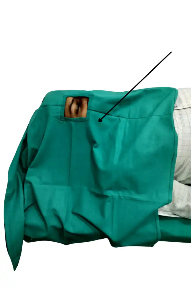 Surgical Eye Hole Sheet